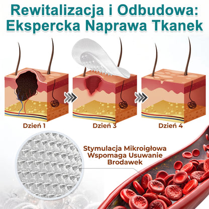 🦚🇵🇱 𝐇𝐞𝒂𝒍𝗿𝗶𝙯𝙚® 2-w-1 Plaster Mikronakłuwający i Hydrokoloidowy 🌿 | Usuwanie wypukłych znamion, trądziku, brodawek płaskich i włókniaków | | Pomaga poprawić wygląd zmarszczek, blizn i niedoskonałości skóry | | Niewidoczne plastry do twarzy i ciała |