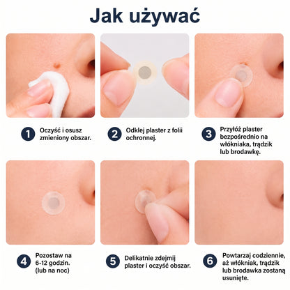 🦚🇵🇱 𝐇𝐞𝒂𝒍𝗿𝗶𝙯𝙚® 2-w-1 Plaster Mikronakłuwający i Hydrokoloidowy 🌿 | Usuwanie wypukłych znamion, trądziku, brodawek płaskich i włókniaków | | Pomaga poprawić wygląd zmarszczek, blizn i niedoskonałości skóry | | Niewidoczne plastry do twarzy i ciała |