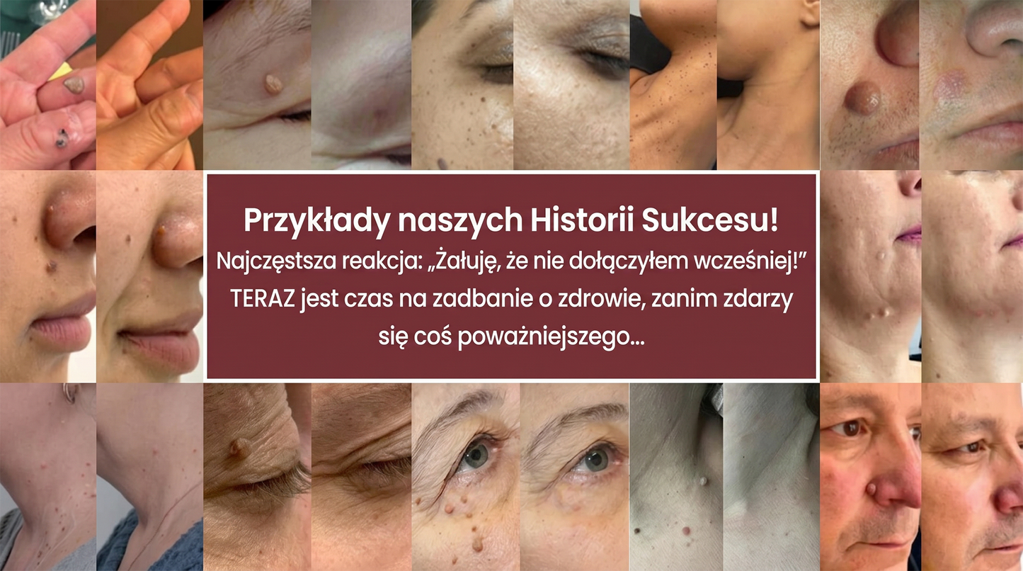 🏵️👍𝐌𝗢𝑷𝙍𝙊® 2 w 1 – mikronakłuwający i hydrokoloidowy plaster 🍀 | usuwa wypukłe znamiona, trądzik, płaskie brodawki i włókniaki skórne | wspiera redukcję zmarszczek, blizn i niedoskonałości | niewidoczne plastry do stosowania na twarz i ciało