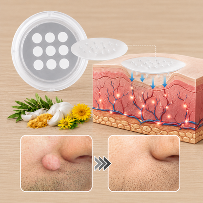 🏵️👍𝐌𝗢𝑷𝙍𝙊® 2 w 1 – mikronakłuwający i hydrokoloidowy plaster 🍀 | usuwa wypukłe znamiona, trądzik, płaskie brodawki i włókniaki skórne | wspiera redukcję zmarszczek, blizn i niedoskonałości | niewidoczne plastry do stosowania na twarz i ciało
