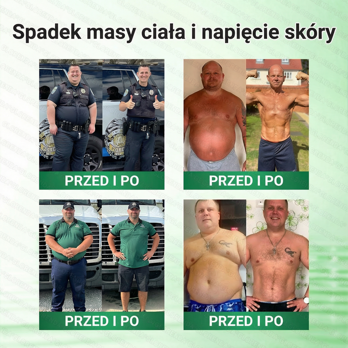 Oficjalny Sklep|☀️Glorenda® Moringa · Berberyna × NAD+ 10-w-1 Zaawansowana Nano Mikronakłuwająca Plaster (tylko raz dziennie, widoczne efekty już po 7 dniach) ✅ Dla osób z otyłością, luźną skórą, cukrzycą, bezdechem sennym, problemami stawowymi i innymi